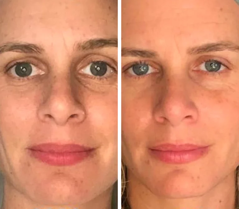 gid://shopify/MediaImage/40579875930330